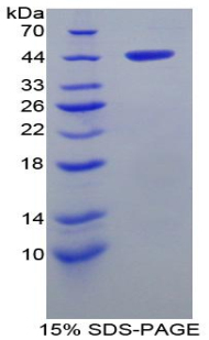 Recombinant Alpha-Hemoglobin Stabilizing Protein (aHSP)