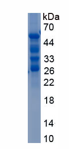 Recombinant Mucin 1 (MUC1)