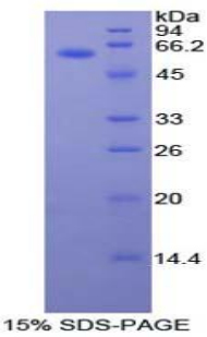 Recombinant Mucin 1 (MUC1)