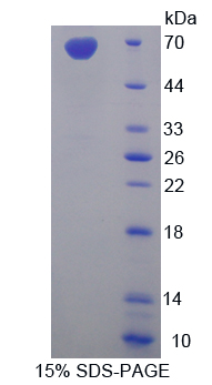 Recombinant Mucin 1 (MUC1)