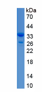 Recombinant Sex Determining Region Y Box Protein 18 (SOX18)