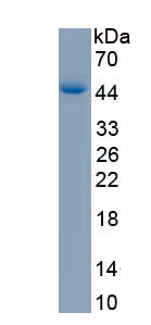 Recombinant Proteolipid Protein 1, Myelin (PLP1)