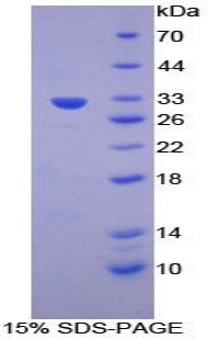 Recombinant Apoptosis Associated Tyrosine Kinase (AATK)