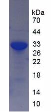 Recombinant Sirtuin 2 (SIRT2)