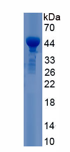 Recombinant Protein Kinase C Delta (PKCd)