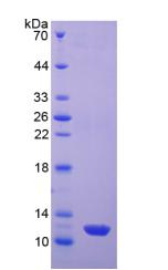Recombinant Estrogen Receptor Beta (ERb)