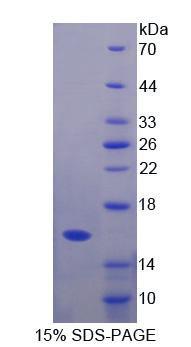 Recombinant Growth Hormone Releasing Hormone (GHRH)