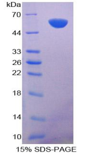 Recombinant Apoptosis Antagonizing Transcription Factor (AATF)