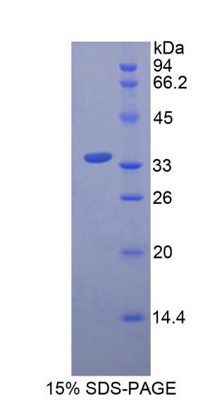 Recombinant Insulin (INS)