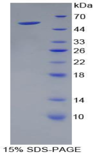 Recombinant Kallikrein 4 (KLK4)