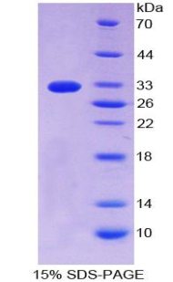 Recombinant Cluster Of Differentiation 55 (CD55)