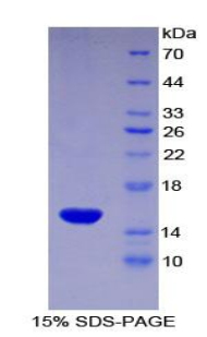 Recombinant Cluster Of Differentiation 55 (CD55)