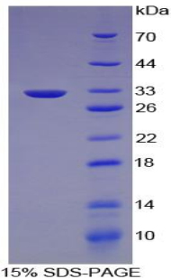 Recombinant Lipase, Endothelial (LIPG)