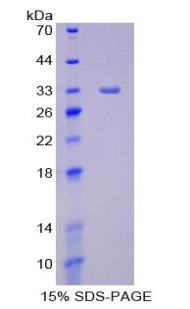 Recombinant Lipase, Endothelial (LIPG)