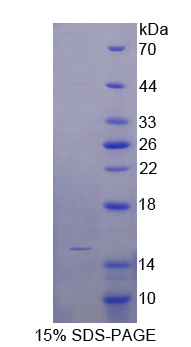 Recombinant Osteocalcin (OC)