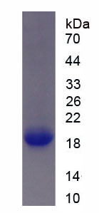 Recombinant Calcitonin (CT)