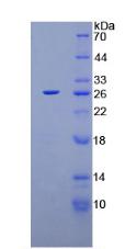 Recombinant Xeroderma Pigmentosum, Complementation Group C (XPC)