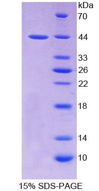 Recombinant Parathyroid Hormone Receptor 2 (PTHR2)