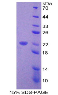 Recombinant Vitamin D Receptor (VDR)