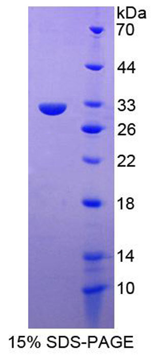 Recombinant Cardiac Troponin I (cTnI)