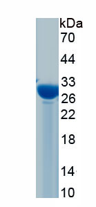 Recombinant Cardiac Troponin I (cTnI)