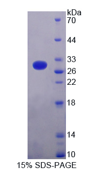 Recombinant Cardiac Troponin I (cTnI)