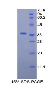 Recombinant Endothelin Converting Enzyme 1 (ECE1)