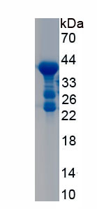 Recombinant N-Terminal Pro-Atrial Natriuretic Peptide (NT-ProANP)