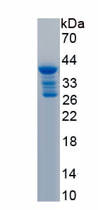 Recombinant N-Terminal Pro-Brain Natriuretic Peptide (NT-ProBNP)