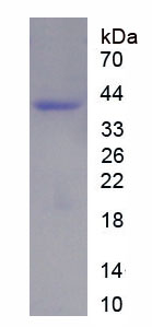 Recombinant Cytokeratin 5 (CK5)