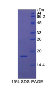 Recombinant Cytokeratin 1 (CK1)