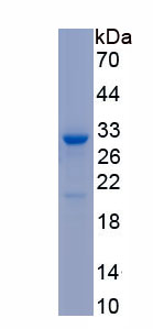 Recombinant Protein Kinase C Iota (PKCi)