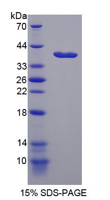 Recombinant Nestin (NES)