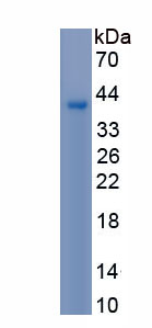 Recombinant Natriuretic Peptide Precursor B (NPPB)