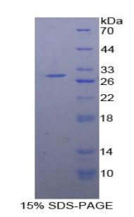 Recombinant Protein Kinase D2 (PKD2)