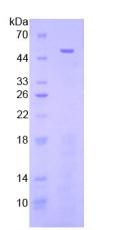 Recombinant Fibrinogen Like Protein 2 (FGL2)