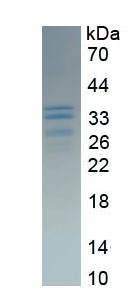 Recombinant Ataxin 1 (ATXN1)