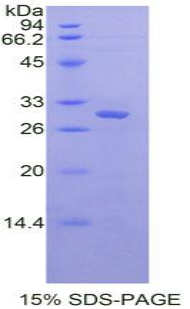 Recombinant Protein Kinase R (PKR)