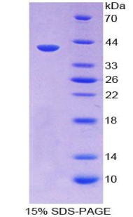 Recombinant Cytokeratin 14 (CK14)