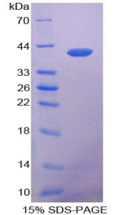 Recombinant Cytokeratin 14 (CK14)