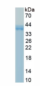 Recombinant Tissue Factor (TF)