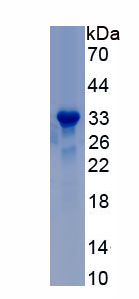 Recombinant Tissue Factor (TF)