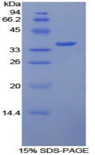 Recombinant Tissue Factor (TF)