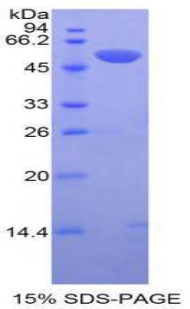 Recombinant Tissue Plasminogen Activator (tPA)