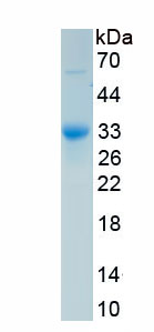 Recombinant Tissue Plasminogen Activator (tPA)