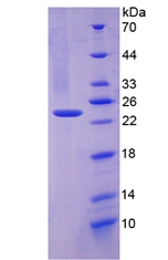 Recombinant Tissue Plasminogen Activator (tPA)