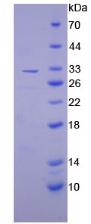 Recombinant Plasminogen Activator Inhibitor 2 (PAI2)