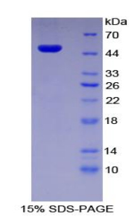 Recombinant Plasminogen Activator Inhibitor 1 (PAI1)