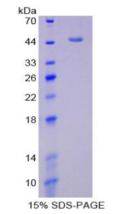 Recombinant Plasminogen Activator Inhibitor 1 (PAI1)