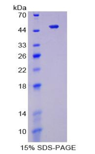 Recombinant Enolase, Neuron Specific (NSE)